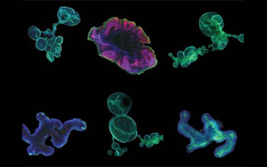 再生醫(yī)學(xué)的未來，到類器官的世界中去