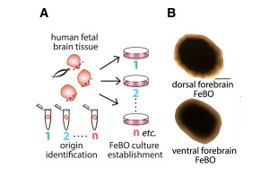 《Cell》新型組織衍生的大腦類器官可能會(huì)給大腦研究帶來革命性的變化