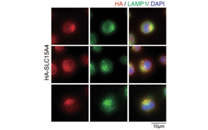 Nature子刊：開創(chuàng)性的將化學(xué)探針引入活細(xì)胞，靶向紅斑狼瘡