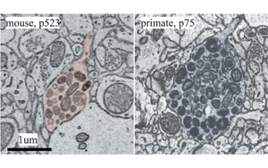 大腦什么時(shí)候長(zhǎng)大?新發(fā)現(xiàn)震驚神經(jīng)科學(xué)家