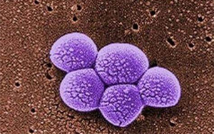 《Science》突破性新抗生素，遏制耐藥細菌