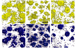 Nature：光和聲可以清除阿爾茨海默氏癥小鼠的淀粉樣蛋白！