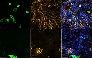 Nature最新研究表明，一類新的抗病毒藥物可以對(duì)抗SARS-CoV-2