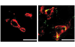 Nature子刊：肝臟中的免疫細(xì)胞會(huì)對(duì)高膽固醇水平做出反應(yīng)，并吃掉多余的膽固醇