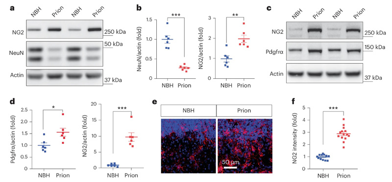 朊病毒疾病模型中NG2膠質(zhì)細胞的激活