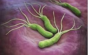 幽門螺桿菌(HP.CagA)-磁微?；瘜W發(fā)光法（AE/AP）解決方案